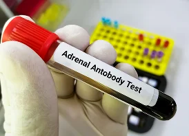 Adrenal_Fatigue_Treatment